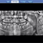 LT-9010DPro New Intelligent Digital Panoramic Cbct Dental X Ray Machine for Human Pet Dog
