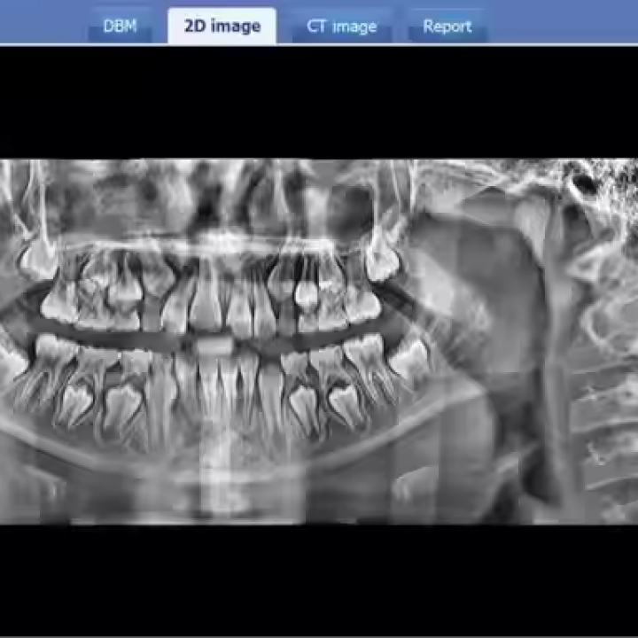 LT-9010DPro New Intelligent Digital Panoramic Cbct Dental X Ray Machine for Human Pet Dog