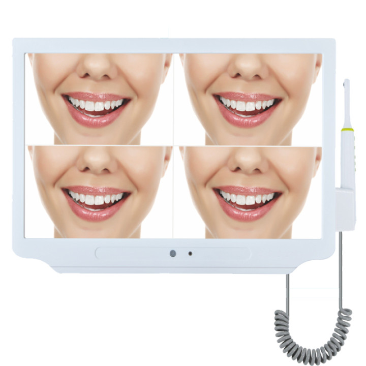 LTDM56 Cheap USB portable 17 inch HD Dental Intraoral Camera