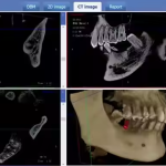 LT-9010DPro New Intelligent Digital Panoramic Cbct Dental X Ray Machine for Human Pet Dog