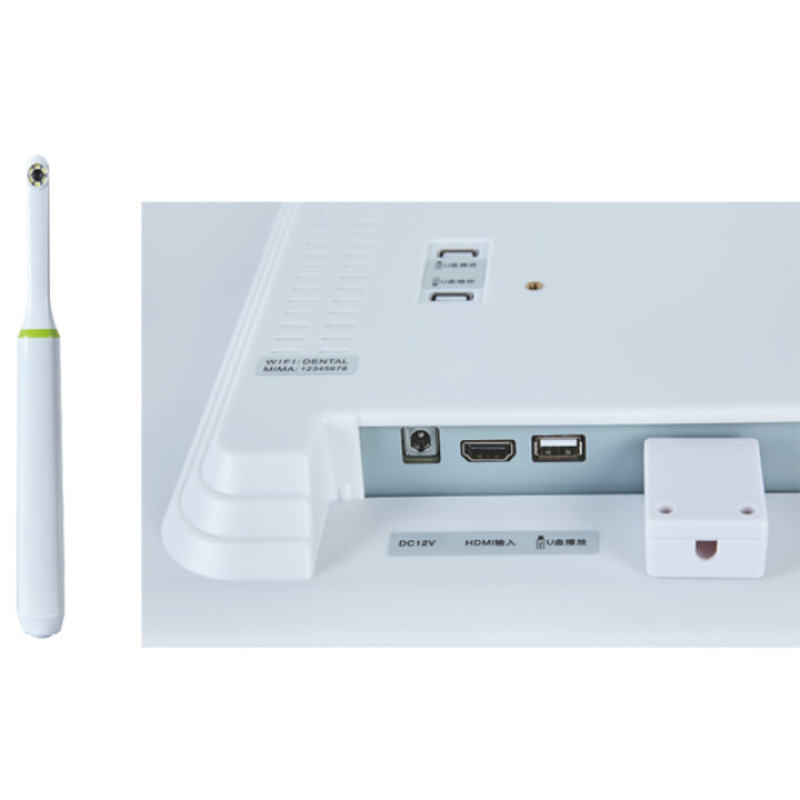 LTDM56 New Arrival Dental Intraoral Camera